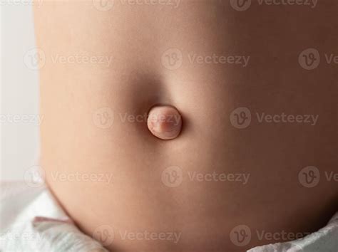 Umbilical hernia in a newborn baby on the stomach. Treatment of