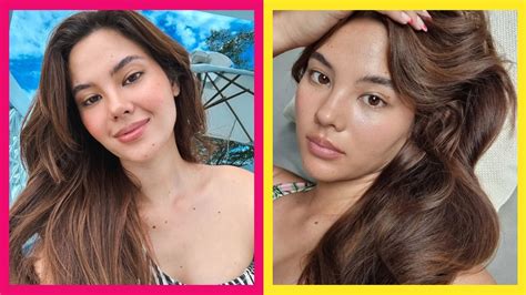 Catriona Gray Opens Up About Acne Breakouts