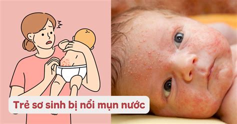 tre  sinh noi mun nuoc li ti  phai tinh trang nguy hiem khong