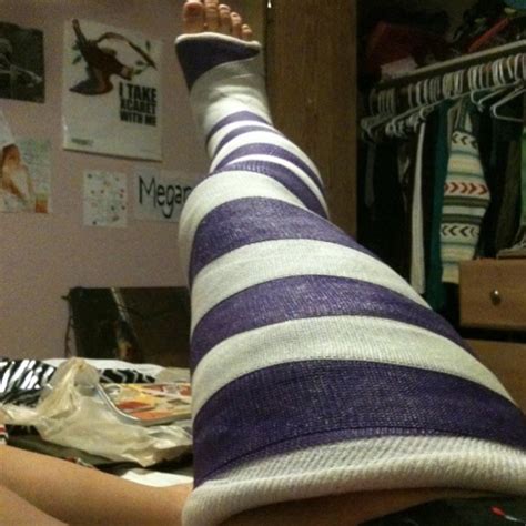 casts  toes  random full leg cast finds