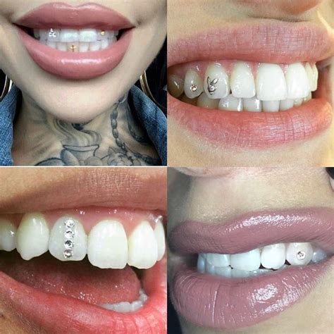 Tooth Gems | Best Little Hair House