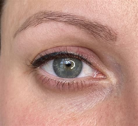 lash line enhancement 5