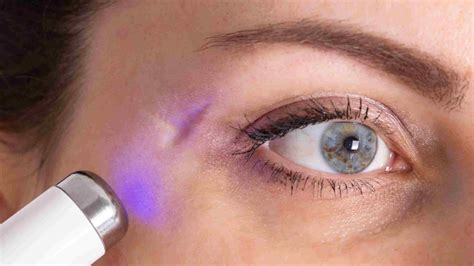 how much does it cost to remove a scar