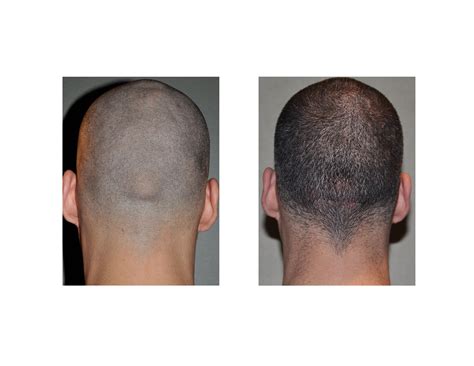 Back Bones Stick Out : Wrist and Hands - Physician Assistant Physical