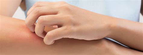 itchy skin  sensitive skin nivea nivea