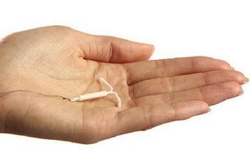 Pregnancy and Intrauterine Device IUD, Birth Control and Side Effects ...
