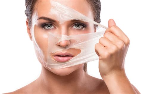 Peeling: Qué es y por qué lo necesitas - Renacek Clínica Estética