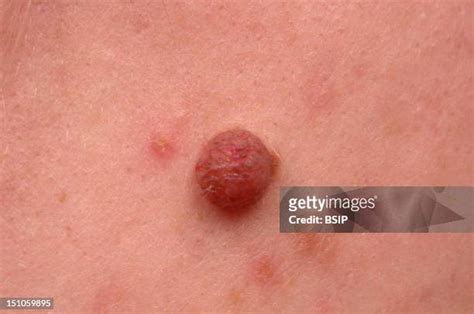 106 Mole On Cheek Stock Photos, High-Res Pictures, and Images - Getty ...