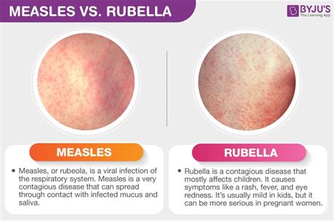measles, rubella,roseola