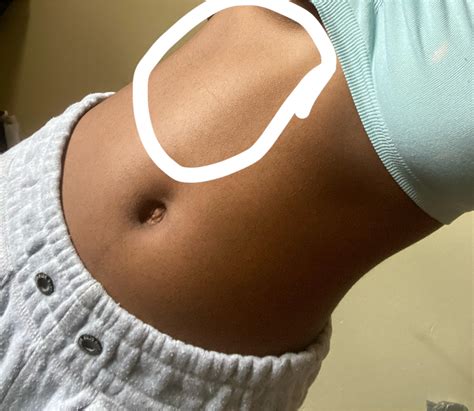 what’s that lump on my upper left abdomen? : r/medical