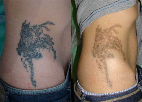 Как выглядит тату когда заживает: Заживление тату - этапы - Tattoo Mall