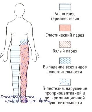 Травма спинного мозга у ребенка - клиника, прогноз