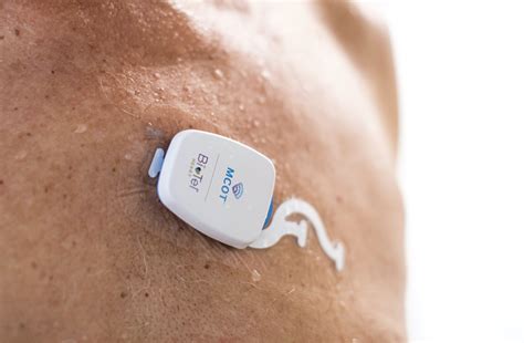 philips mobile cardiac telemetry mcot biotelemetry  philips company