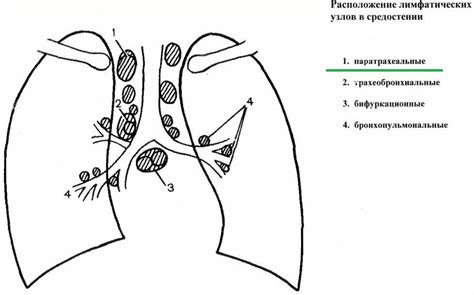 Паратрахеальные лимфоузлы увеличены: причины и лечение
