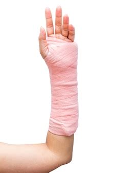 Splint, сломанной кости, сломанной руки изоляции на белом фоне ...