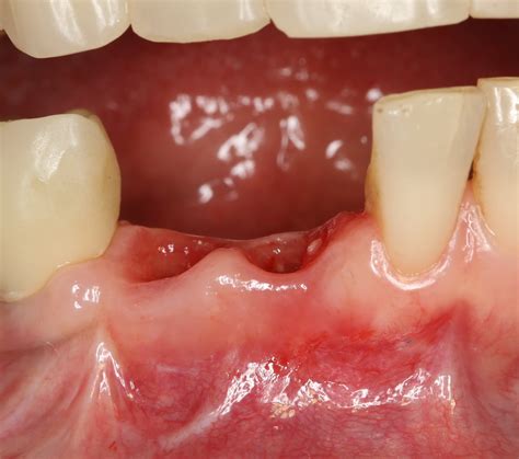 «Мне говорили, что это невозможно…» © — IMPLANT-IN.COM — дентальная ...