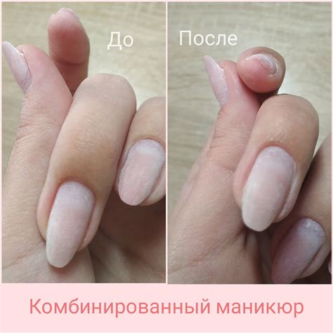 Птеригий в маникюре (57 фото) - картинки modnica.club