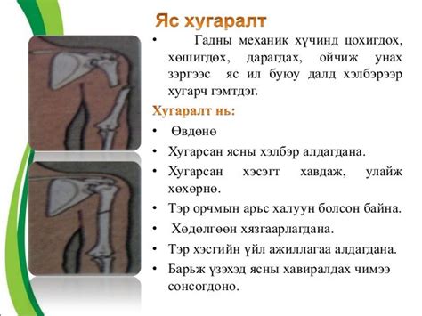 Анхны тусламж үзүүлэх семинар О.Батбаяр