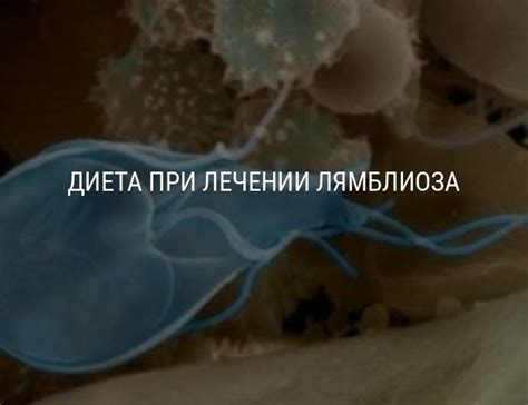 Диета при лямблиозе: разрешенные продукты, правила питания при лечении ...