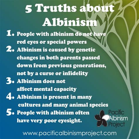 1000+ images about Stunning Beauty of Albinism on Pinterest | Albinism ...