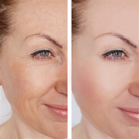 PRP Therapy in Stuart & Delray Beach | Natural Skin & Hair Rejuvenation