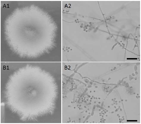 Typical images of Trichophyton obtained from the scales of the feet and... | Download Scientific ...