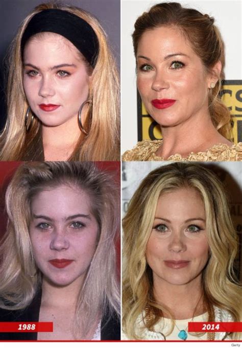 'Dead to Me' Christina Applegate's Plastic Surgery - Does Her Before ...