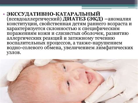 Экссудативно-катаральный диатез - презентация онлайн