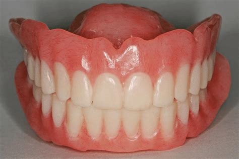 denture implants  maduraidentures  madurai