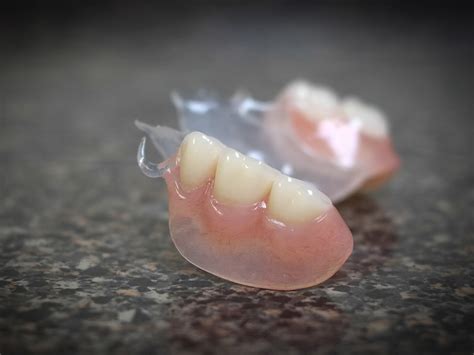 flexible dentures olds denture implant centre