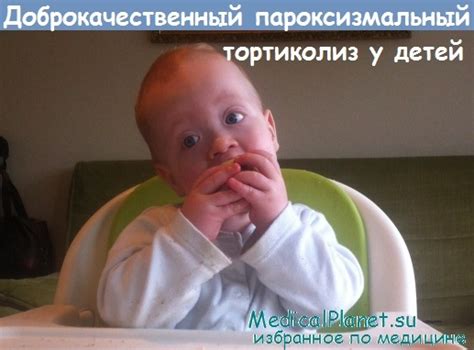 Доброкачественный пароксизмальный тортиколиз у детей - признаки