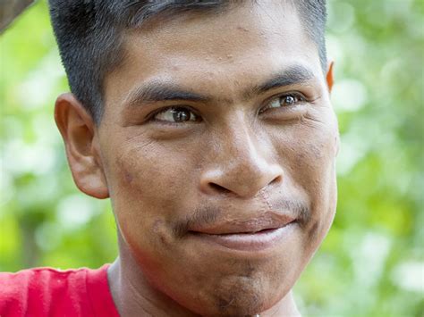 Mexico | Operation Smile