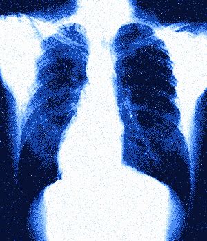 Гифка легкие дышит air гиф картинка, скачать gif на GIFER