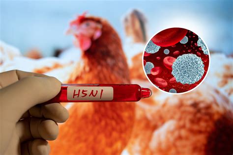 Bird Flu Update: How Regular Influenza May Help Protect You - Newsweek