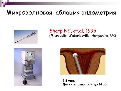 Аблация эндометрия: выбор оптимального метода, результаты лечения ...