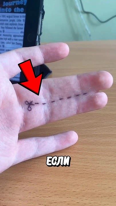 Сросшиеся Пальцы! 🤯 - YouTube