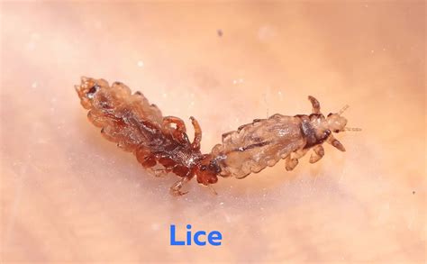 lice control services  nairobi rafiki pest control
