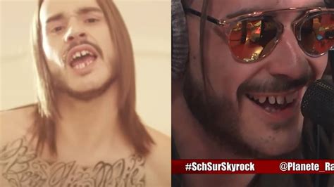 Les dents de SCH : Un sujet qui passionne