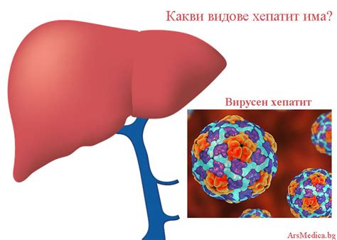 Видове хепатит – вирусен, автоимунен, алкохолен хепатит - ArsMedica.bg