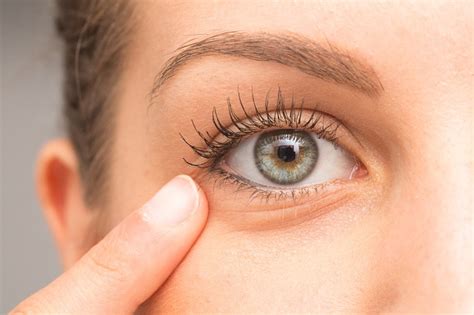 Under-eye wrinkles: causes and how to prevent them | DietZones