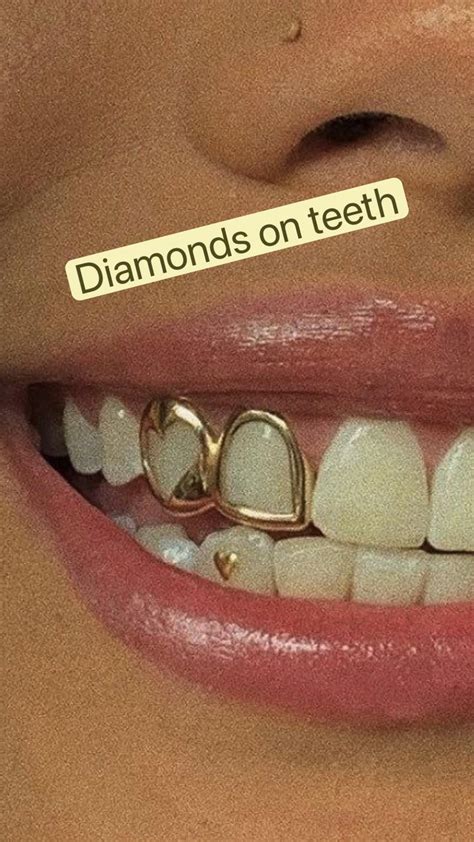 Diamonds on teeth | Bijou dentaire, Dentaire, Fausses dents