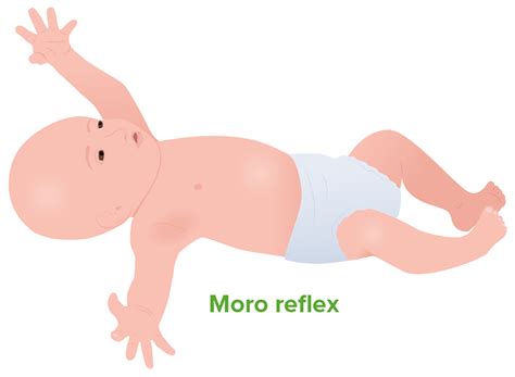 Reflexo De Moro Durante O Sono - Reflexos Primitivos | Concise Medical Knowledge