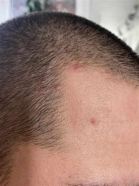 Pain in my left leg last night from ankle to the top. Today I found red