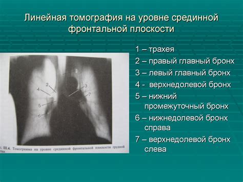 Методы рентгенодиагностики - презентация онлайн