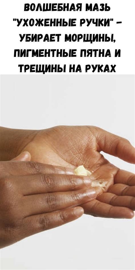 Волшебная мазь «Ухоженные ручки» — убирает морщины, пигментные пятна и ...