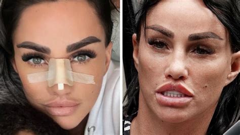 katie price     surgery   chronicle