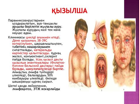 Терінің іріңді зақымдалуымен фурункул, абсцесс, флегмона екшеу ...