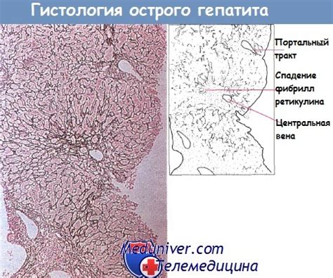 Вирусы гепатитов - характеристика, особенности поражения печени