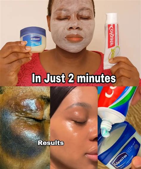 Uncover the Viral Toothpaste & Vaseline Skincare Secret That’s Taking ...