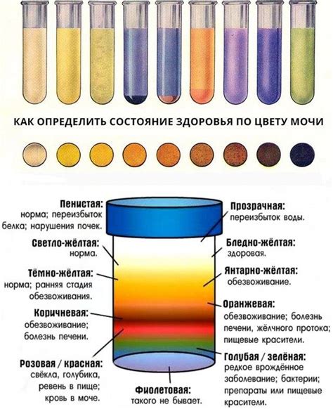 Изменение цвета мочи причины, какие заболевания